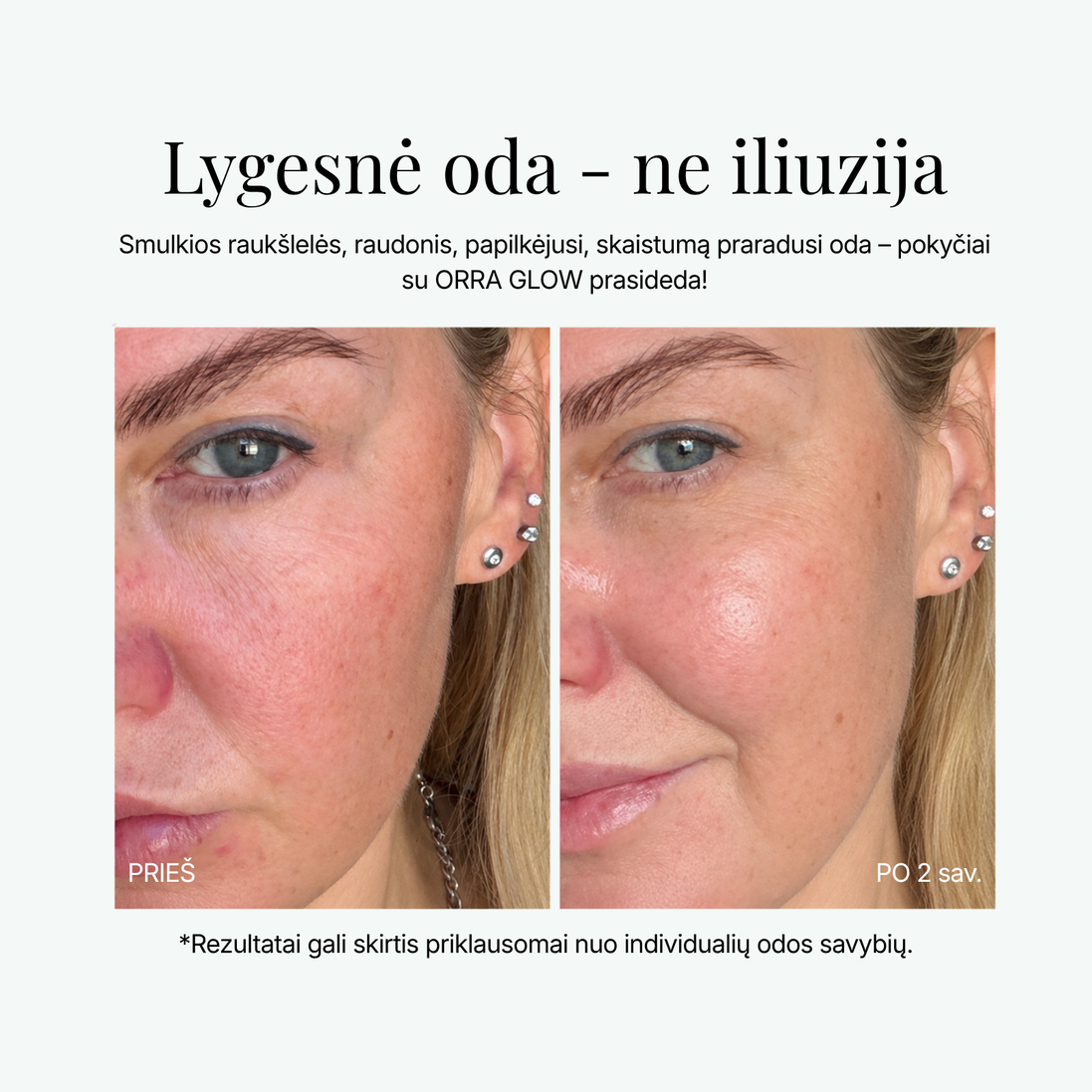 ORRA GLOW ALL-in-1
